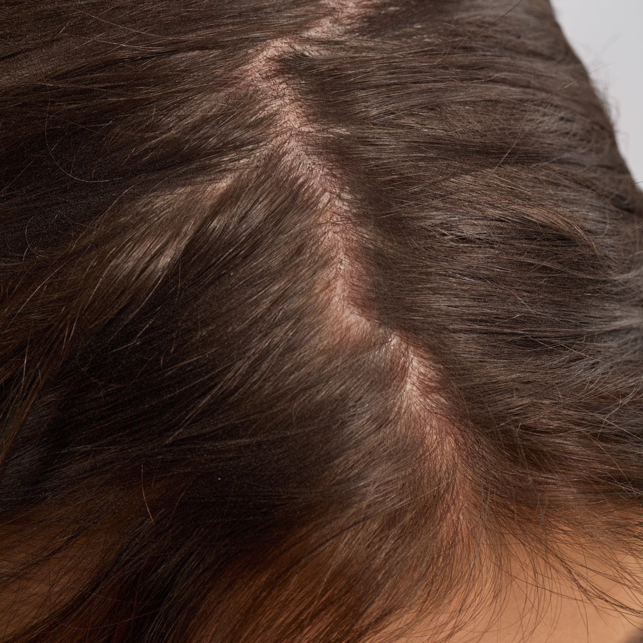 67830-60633-67823-Scalp_HairOilApplicator-Terracotta-Model-Consumables-2-Before-1280x1280px.jpg